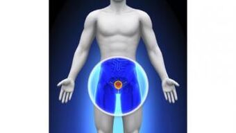Prostatitis in a man