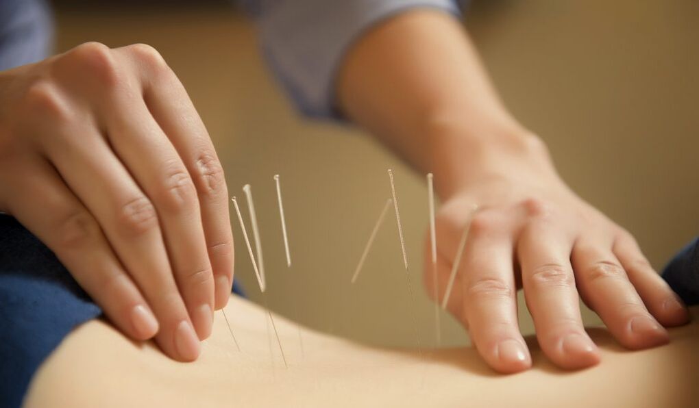 Acupuncture is a common method for treating chronic prostatitis